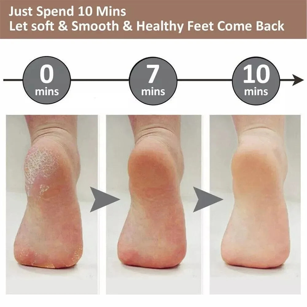 SilkFeet™ – Samtweiche Füße in 5 Minuten