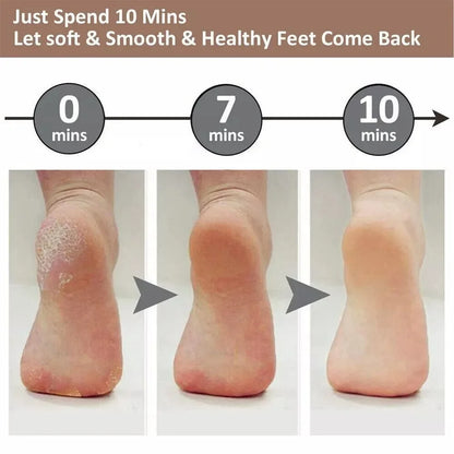 SilkFeet™ – Samtweiche Füße in 5 Minuten
