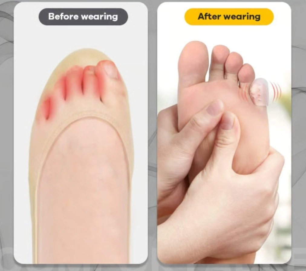 Druckentlastung für kleine Zehen - 10 Stück