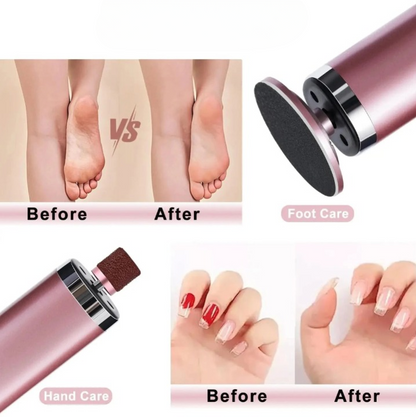 SoftStep™ – Salon-Weiche Füße zu Hause in Minuten