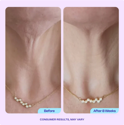 MOIKA Halscreme: Straffung in 4 Wochen