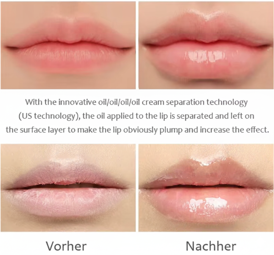 Lip Maximizer - Fülliger Lippen Serum