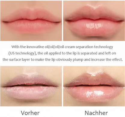 Lip Maximizer - Fülliger Lippen Serum