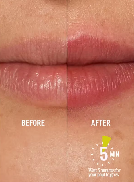 Invisi-Volumen Liner Lippen - Sofort Voller, Keine Nadeln