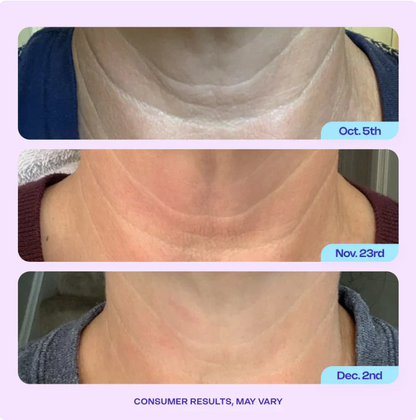 MOIKA Halscreme: Straffung in 4 Wochen